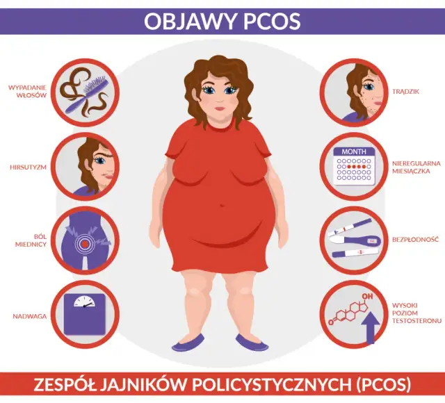 PCO syndrom co to jest – objawy, przyczyny i wpływ na zdrowie kobiet