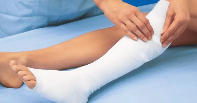 Jak postępować przy złamaniu otwartym - ważne kroki pierwszej pomocy