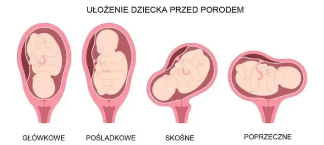 Kiedy dziecko obraca się główką w dół? Poznaj kluczowe informacje