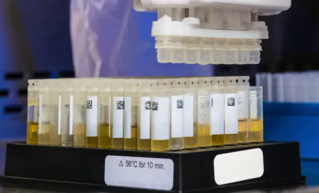 Czy badanie krwi wykryje amfetaminę? Co musisz wiedzieć o testach