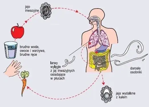 Pasożyty w ciele: 7 alarmujących objawów i co robić?