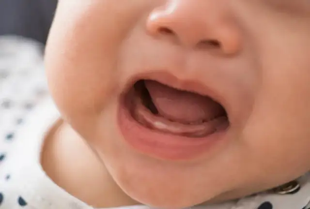 Ząbkowanie: Jak wyglądają dziąsła niemowlaka? Zdjęcia i porady