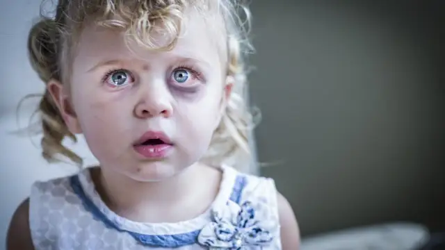 Maltretowanie dziecka: Rozpoznaj ukryte objawy i reaguj!