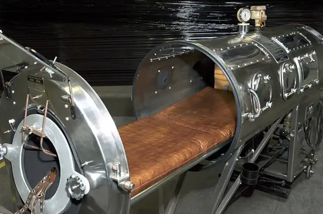 Cómo funciona el pulmón de acero y su impacto en la respiración