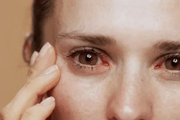 Jak złagodzić ból oczu - skuteczne sposoby na ulgę i komfort