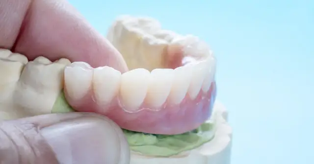 Dłoń trzyma protezę zębową na tle gipsowego modelu. Zastanawiasz się, ile kosztuje sztuczna szczęka?