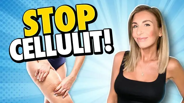 Jak pozbyłam się cellulitu? Moja sprawdzona strategia krok po kroku