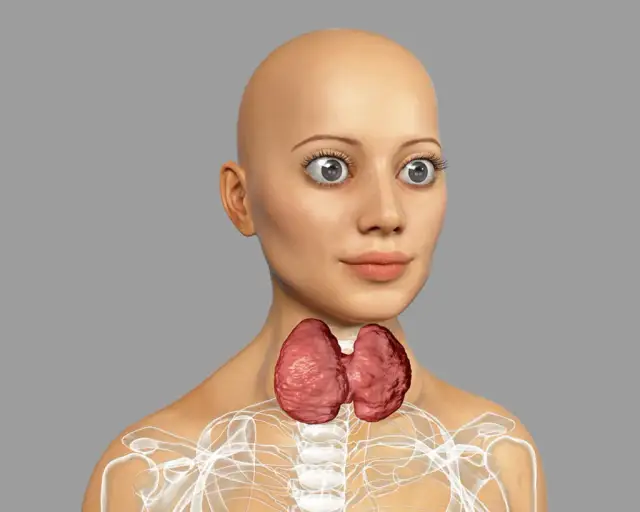 Gravesa-Basedowa: Objawy, których nie możesz ignorować