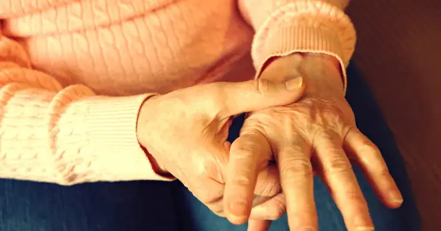 Dłonie osoby z RZS, która szuka pomocy u lekarza.