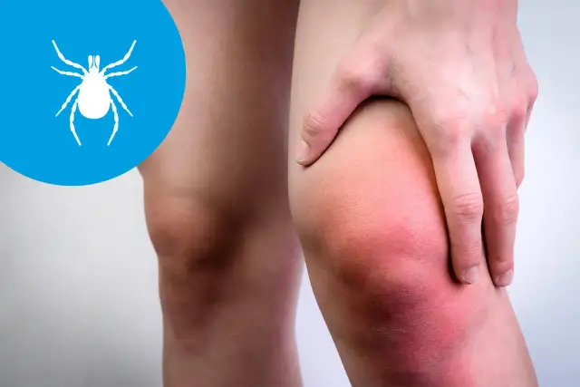 Ból kości, stawów i swędzenie skóry: Kiedy to sygnał alarmowy?