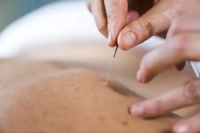 Zastój krwi w medycynie chińskiej: przyczyny, objawy i skuteczne leczenie