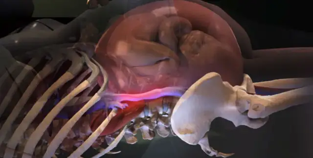 Jak ułożyć kobietę w ciąży w pozycji bezpiecznej, aby uratować życie