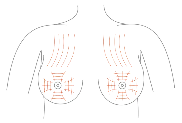 Ile kosztuje korekta biustu? Ceny i czynniki wpływające na koszt