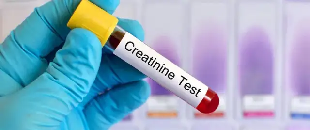 Kreatynina: przygotowanie do badania. Wyniki bez fałszu!