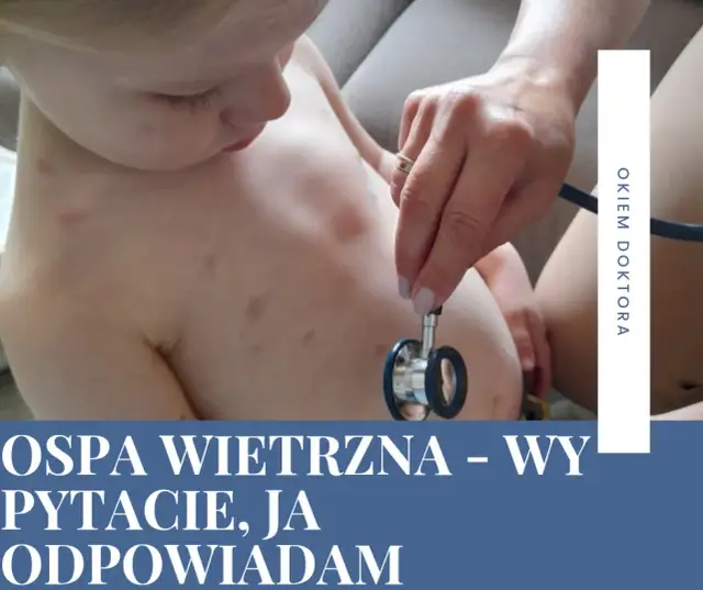Kiedy po ospie do przedszkola? Sprawdź, kiedy dziecko może wrócić