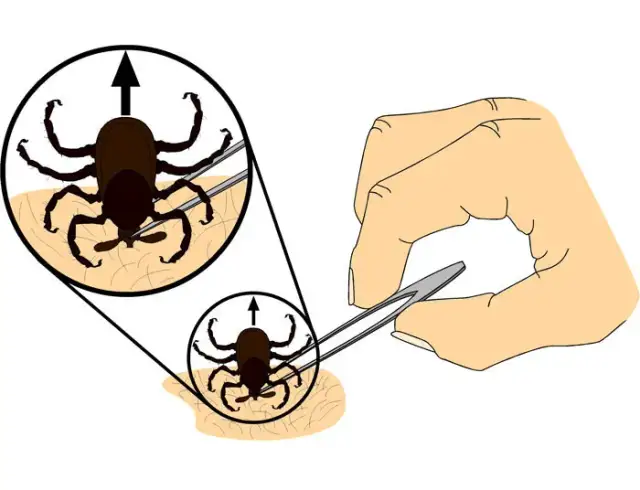 Cómo matar una garrapata de forma segura y evitar infecciones