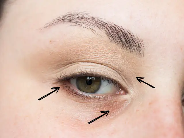 Jak ukryć worki pod oczami? Makijażowe triki ekspertki