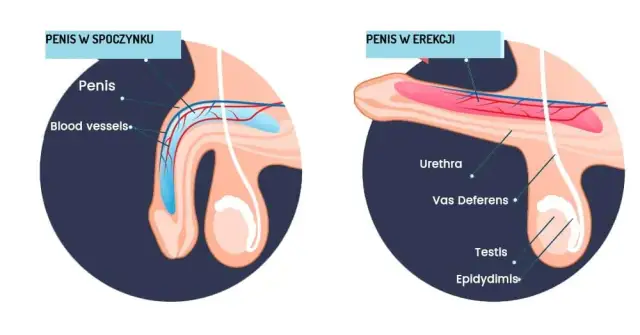 Zaburzenia erekcji objawy: Jak rozpoznać problemy z erekcją?