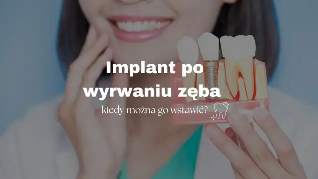 Alkohol po wyrwaniu zęba? Sprawdź, kiedy jest bezpieczny i dlaczego musisz uważać