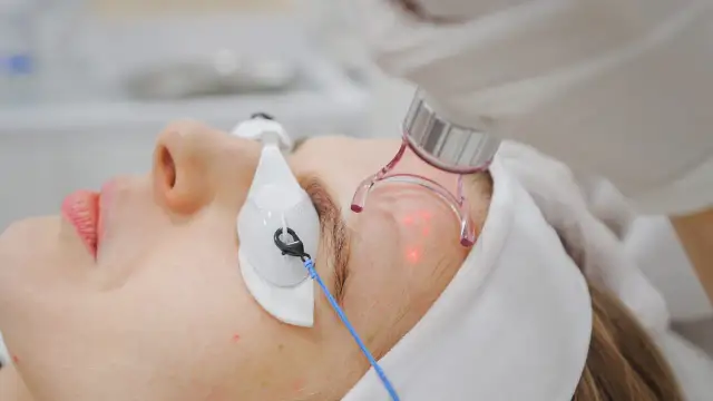 Laser frakcyjny czy boli? Oczekiwany ból i sposób na jego złagodzenie