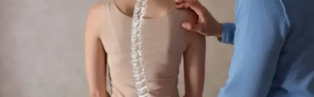 Skolioza: Ćwiczenia, które leczą, i te, których musisz unikać