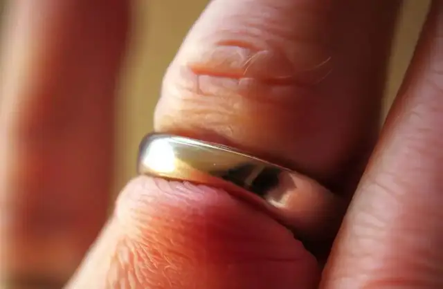Przecięcie obrączki: koszt, gdzie i jak to zrobić bezpiecznie?