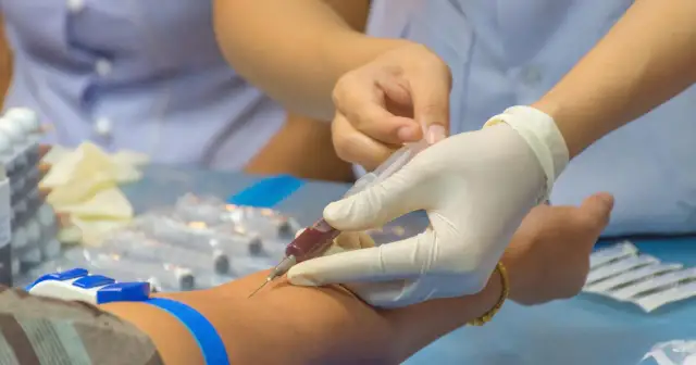 Zaburzenia hemostazy: objawy skaz krwotocznych i nadkrzepliwości