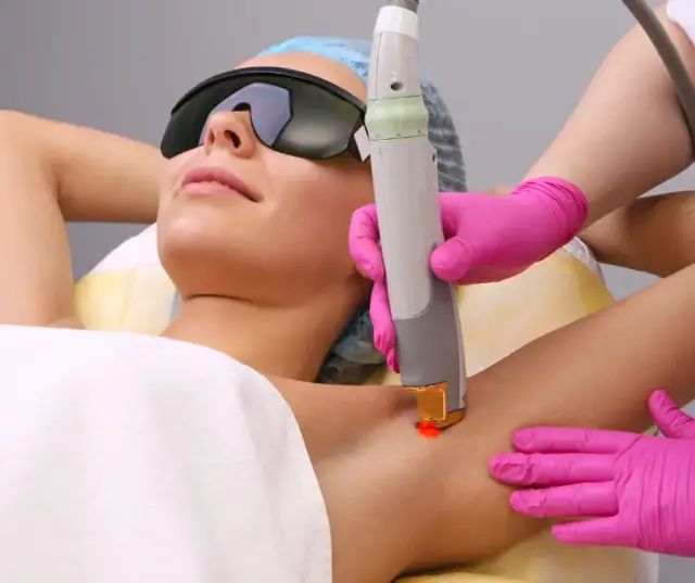 Czy po depilacji laserowej można się opalać? Uniknij powikłań!