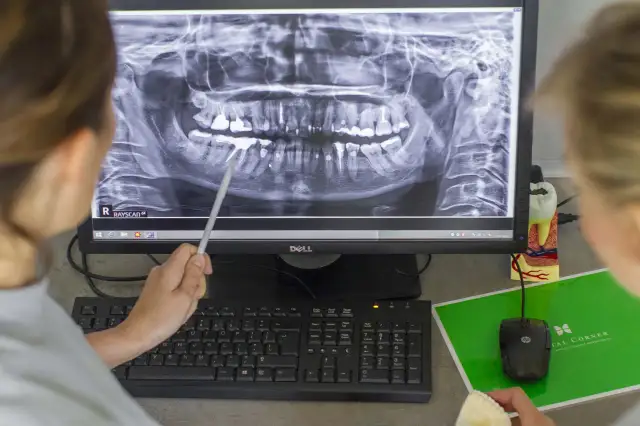 Górna dwójka: Jeden kanał to norma? Sprawdź, co mówi dentysta