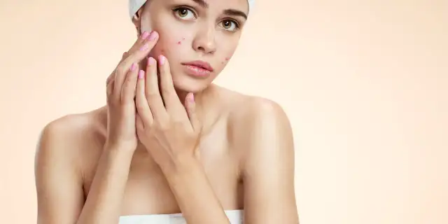 Pryszcze na czole: Rozszyfruj sygnały skóry i ciesz się gładką cerą