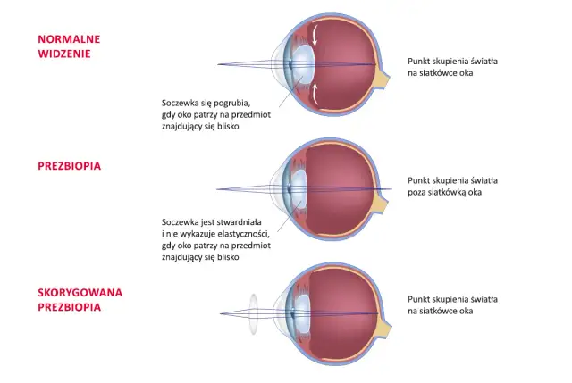 Nie widzisz z bliska? Jakie okulary wybrać na prezbiopię?