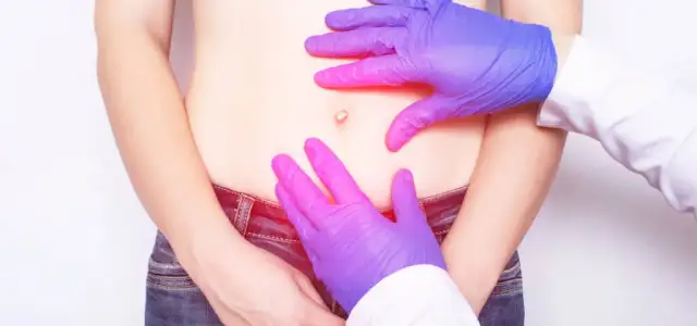 Przepuklina kresy białej u dziecka: objawy, leczenie i powikłania