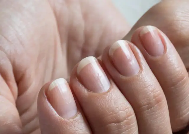 Jak odrasta paznokieć po zerwaniu? Pełny przewodnik regeneracji