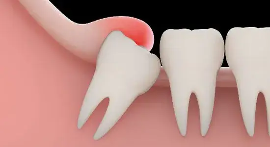 Jak wzmocnić zęby i dziąsła? Kompletny poradnik krok po kroku
