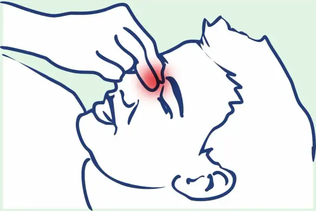 Skuteczne sposoby na ból zatok bez kataru, które przynoszą ulgę