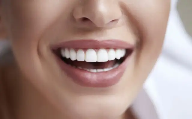 Ile licówek na zęby? Od 1 do 20 - poznaj swój idealny uśmiech