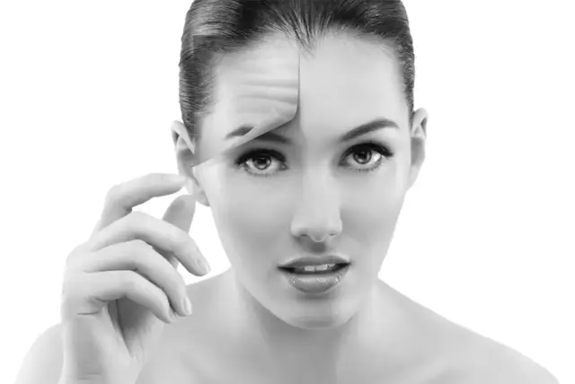 Kobieta z botoksem na czole, pokazująca efekt wygładzenia zmarszczek.