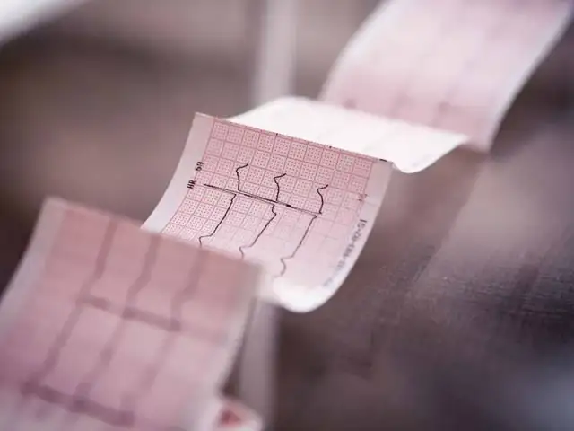 Prawidłowy puls u dzieci – co musisz wiedzieć, aby dbać o zdrowie