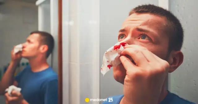 Jak zatamować krwotok z nosa u dziecka? Spokój i skuteczne kroki