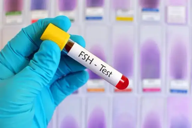 Ile kosztuje badanie FSH? Ceny, NFZ i jak zaoszczędzić!