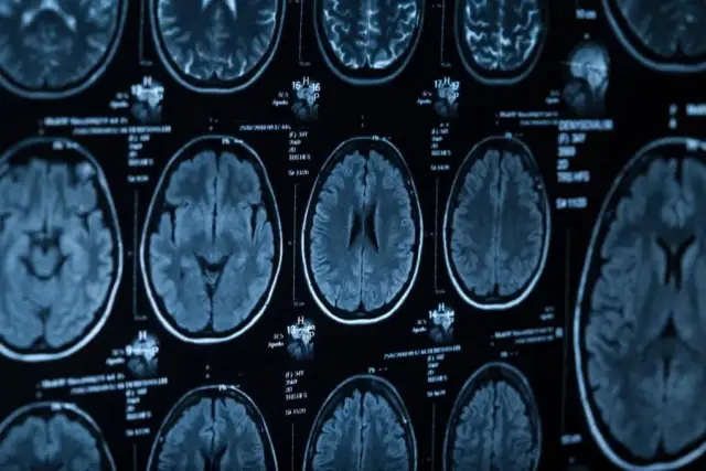 Ile trwa tomograf głowy? Poznaj czas badania z kontrastem i bez