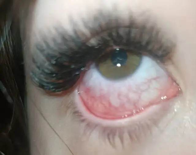 Czerwone oczy po założeniu rzęs? Sprawdź, jak to złagodzić i uniknąć bólu