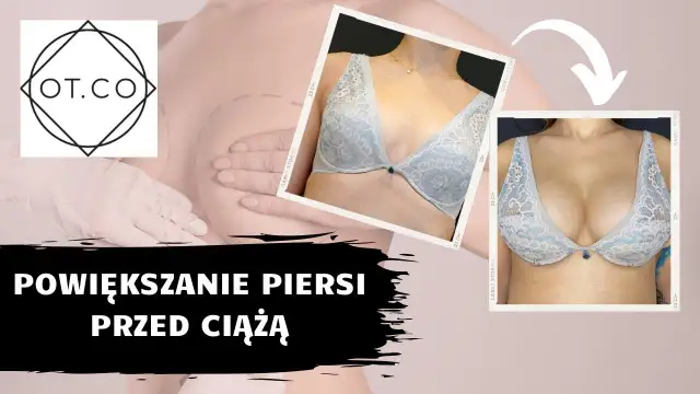 Naturalne powiększanie biustu: Fakty, mity i co naprawdę działa?