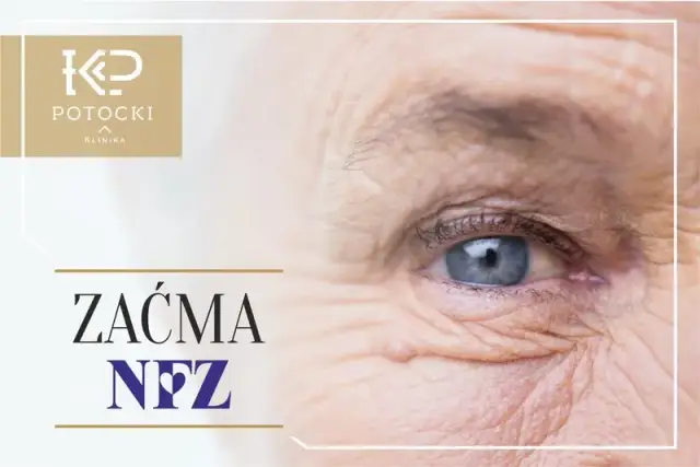 Zaćma: NFZ czy prywatnie? Gdzie najlepiej operować? Poradnik