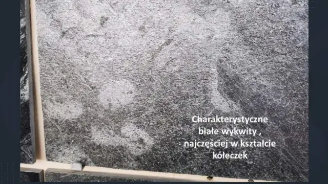 Biały nalot na kostce - Wykwity? Jak usunąć i zapobiegać