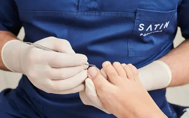 Jak obciąć zgrubiałe paznokcie bez bólu i ryzyka uszkodzeń