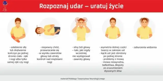 Jak zapobiec udarowi? 7 kluczowych kroków do zdrowego mózgu
