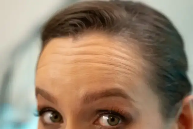 Czym się różni botoks od kwasu hialuronowego – kluczowe różnice i efekty