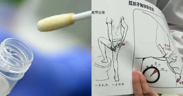 Jak zrobić wymaz z odbytu dziecku - krok po kroku bez stresu