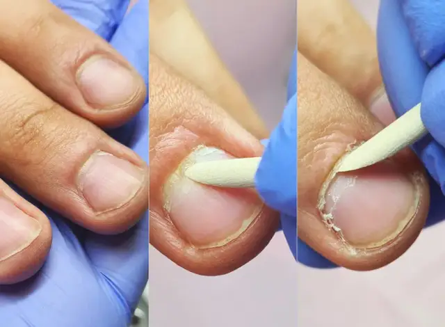 Manicure męski na czym polega? Poznaj etapy i zyskaj zdrowe dłonie